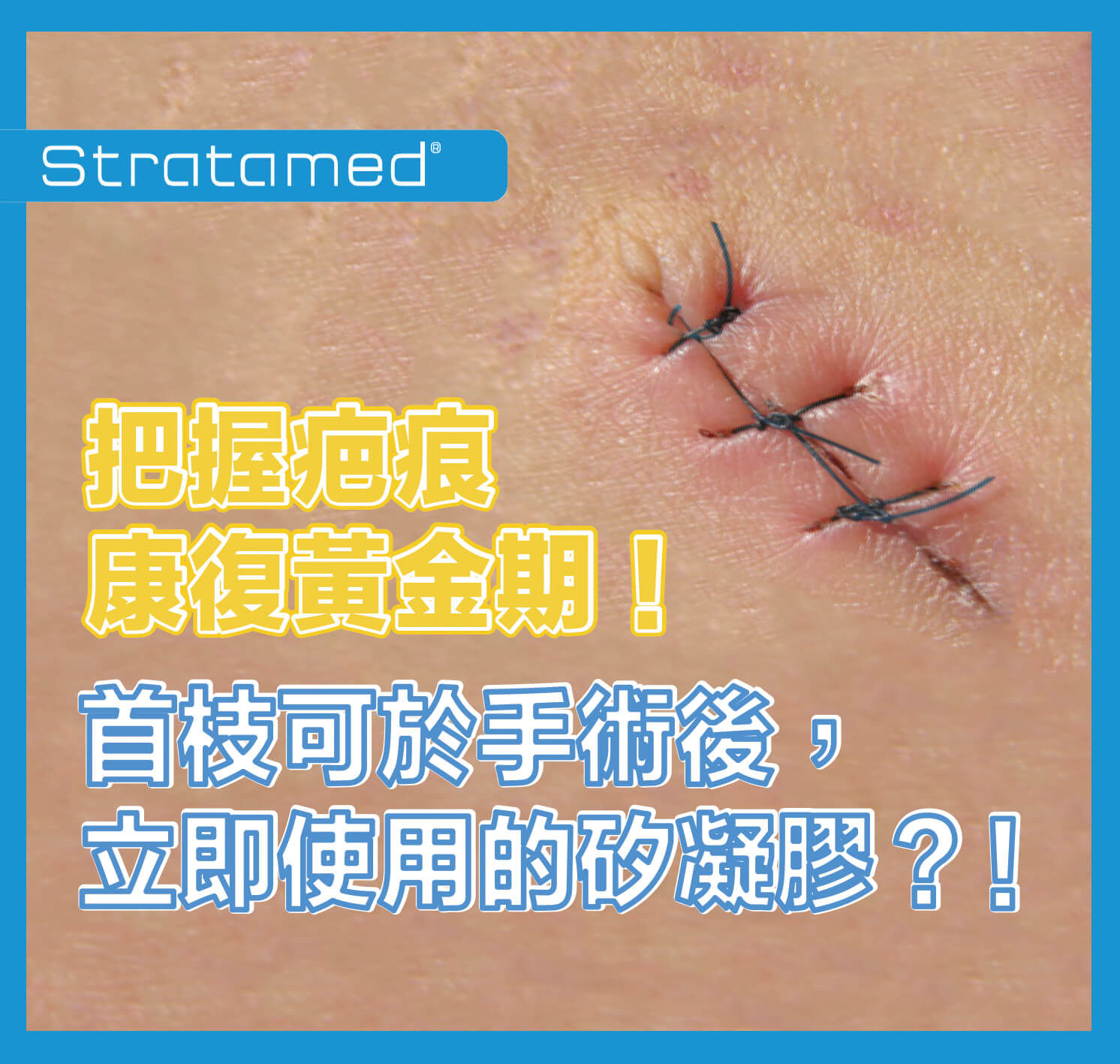 矽凝膠 除疤凝膠／除疤膏 邊隻好 Stratamed 1